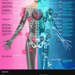 Nanotecnología para el cuerpo humano #infografia #infographic #health